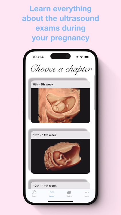 ScanBaby learn baby ultrasound screenshot-6