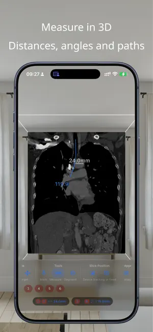 VoxelVision AR Medical Imaging screenshot 2