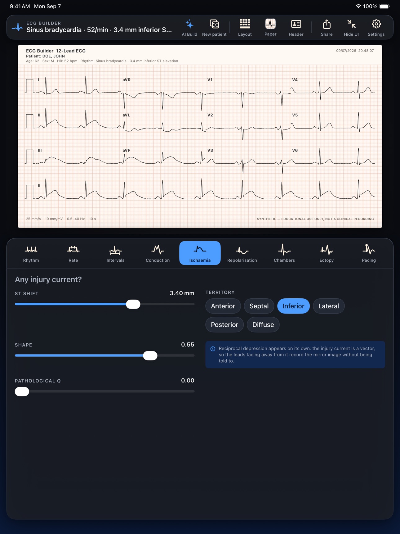 Screenshot 8 of ECG Builder