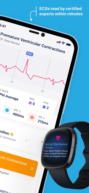 Afib Ecg App Ios Afib Ecg Apple Watch App Ecg Apple Watch Apple