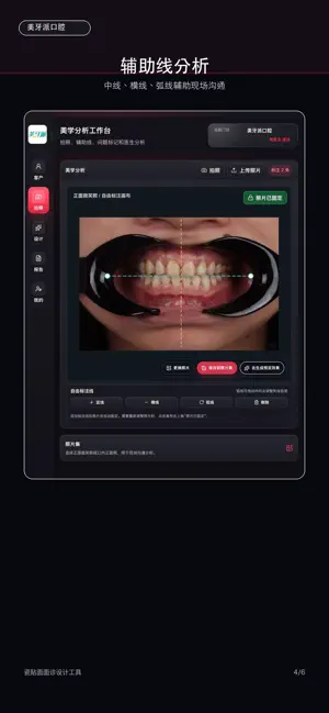 VeneerStudio screenshot 4