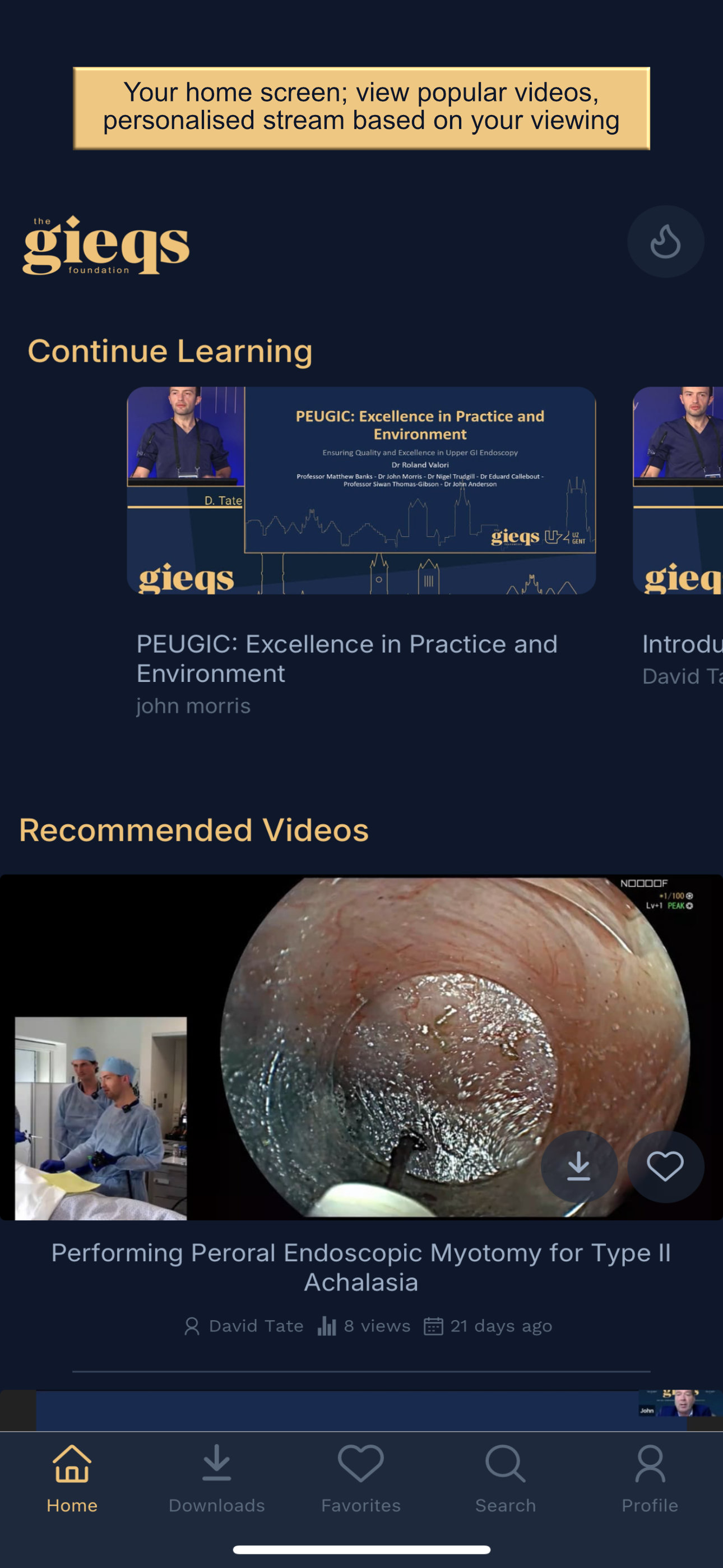 GIEQs - the App