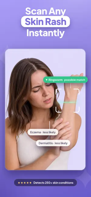 Rash Scan: AI Dermatologist screenshot 1