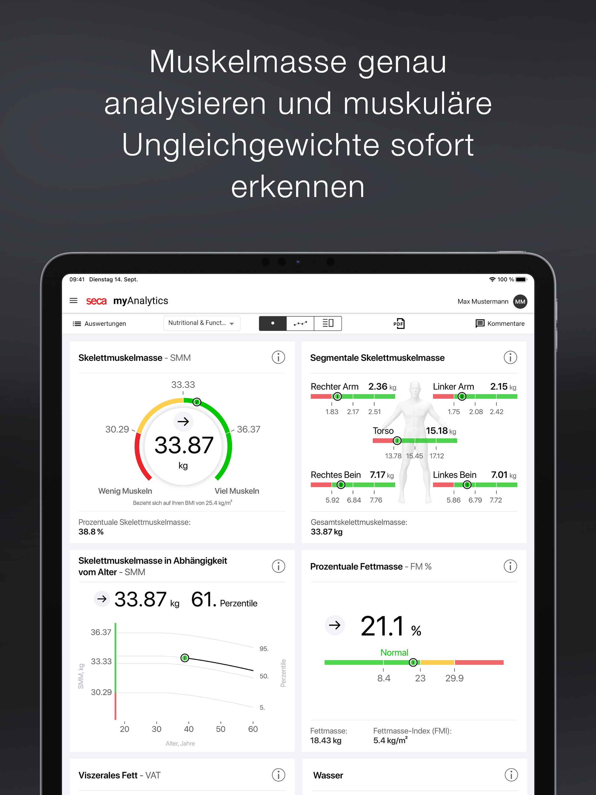 AI Translator-photo translate