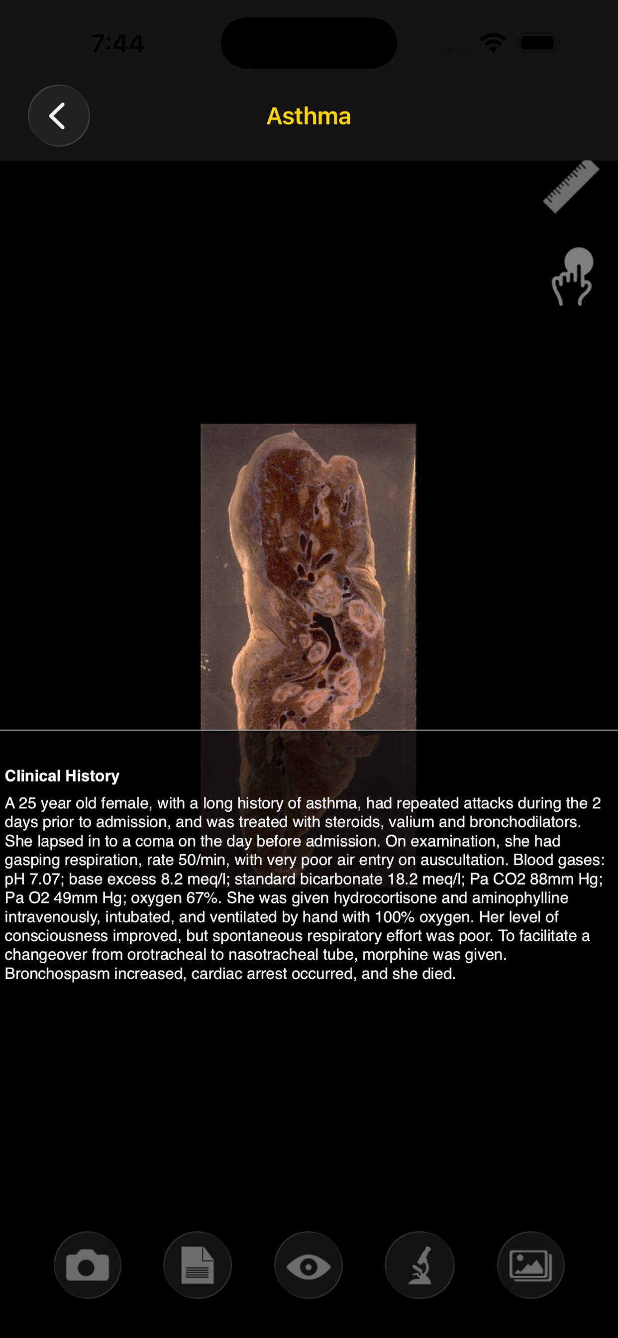 Images Of Disease