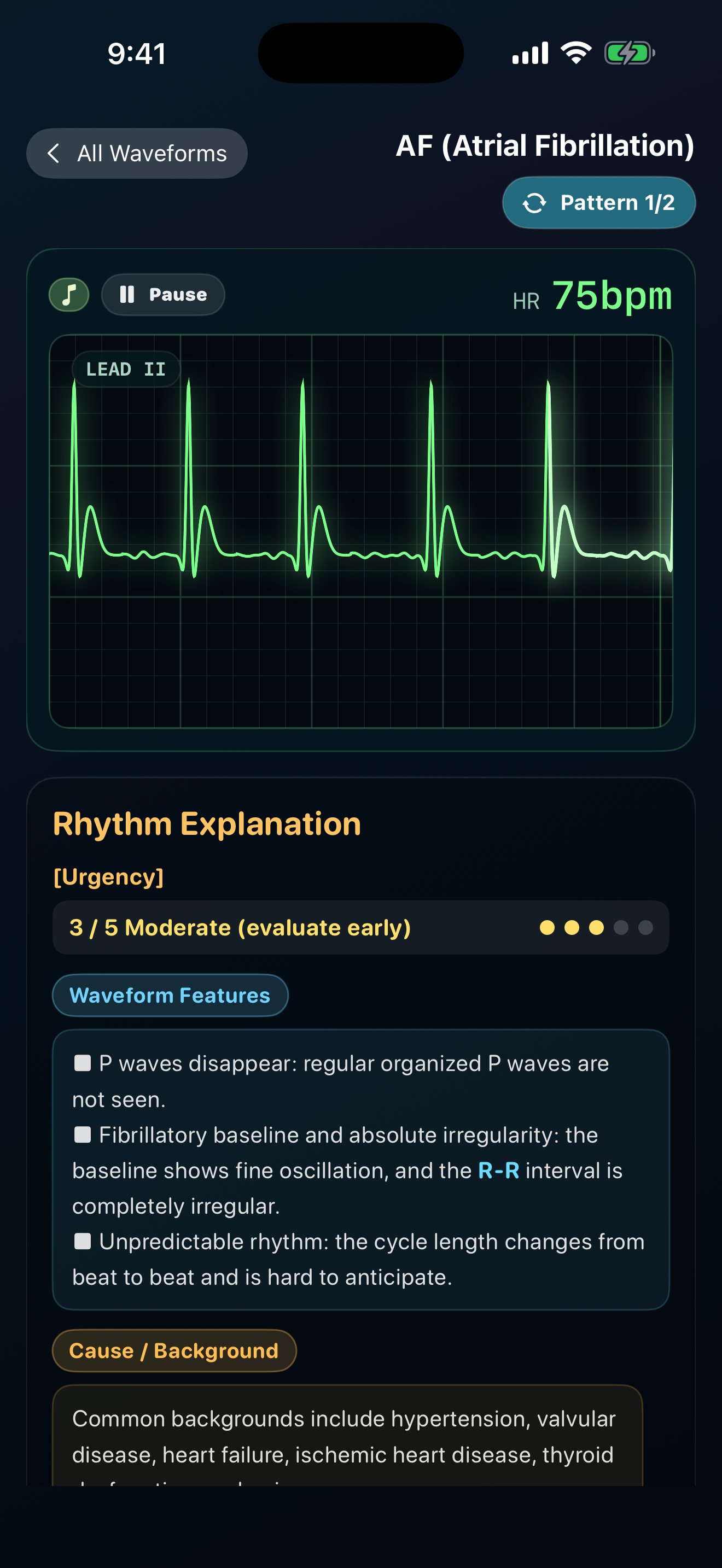 ECG Trainer: Monitor & 12-Lead screenshot 3