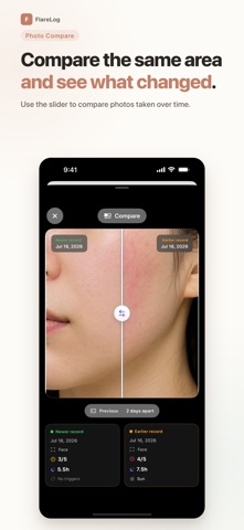 Eczema Tracker - FlareLog screenshot