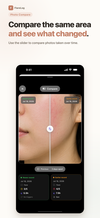 Eczema Tracker - FlareLog Screenshot 1 of 7