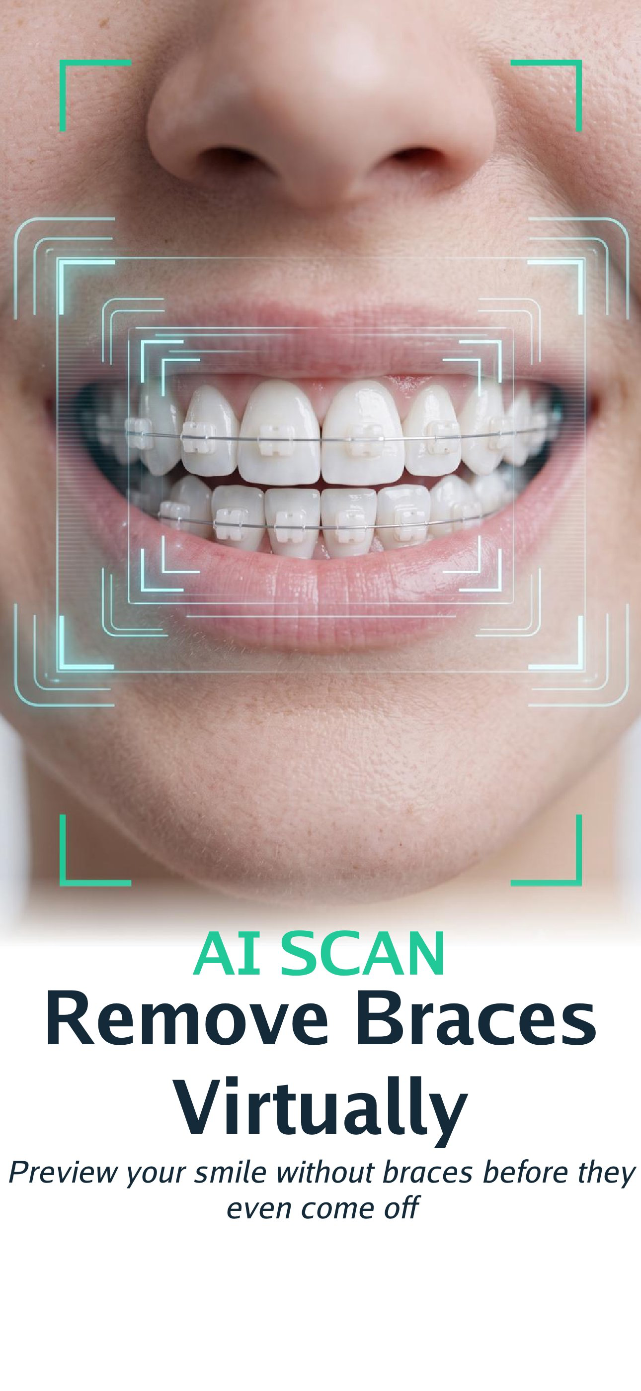 Smile: Perfect Teeth Fix screenshot 4