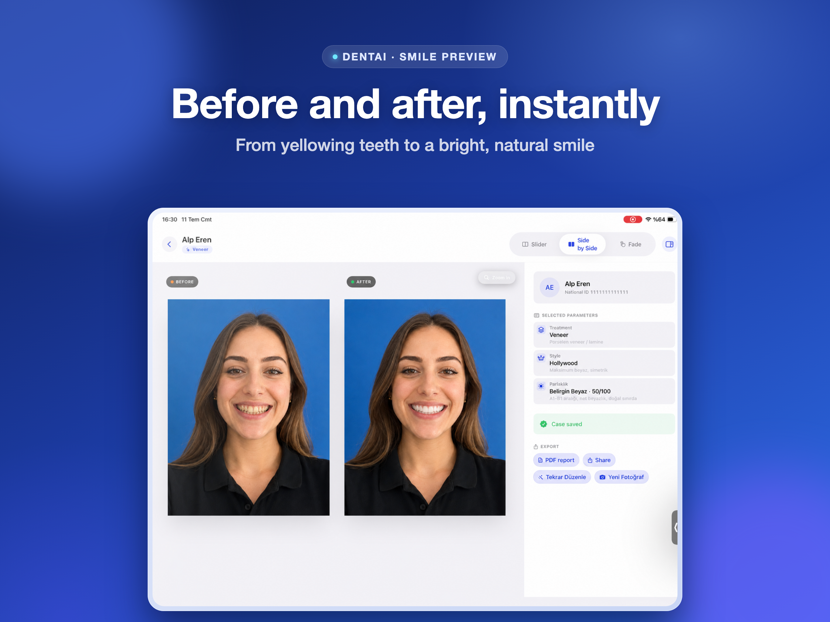 DentAI: Dental Preview AI screenshot 6