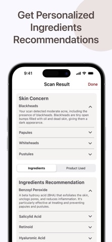 Skinalyze Screenshot 4 of 5