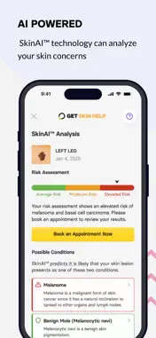 GetSkinHelp screenshot 2