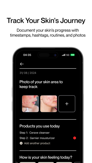 Skin Diary: Track & Glow screenshot 2