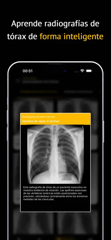Chest X-ray Academy: Learn CXR screenshot 5 of 5