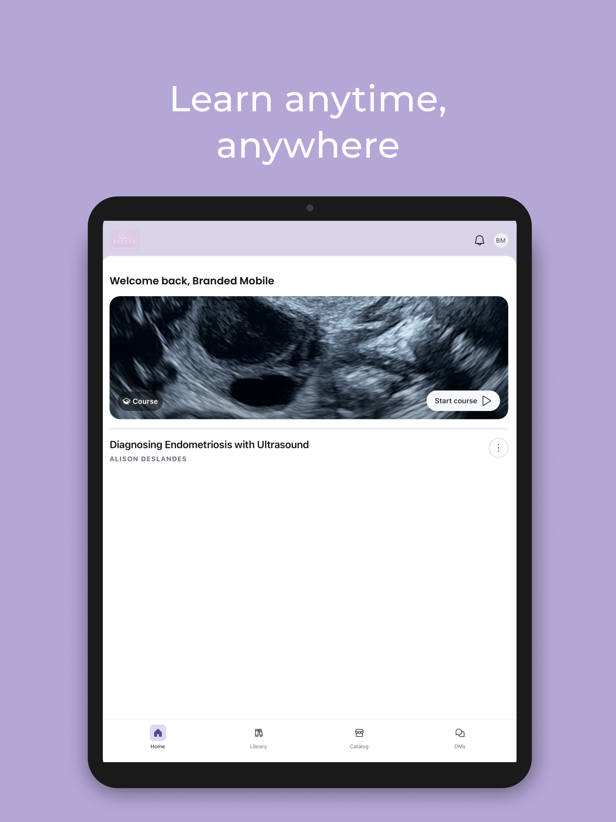 AIMEE: My Ultrasound Mentor