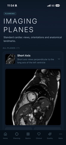 MyoScan IQ: Cardiac MRI Guide screenshot