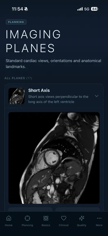 MyoScan IQ screenshot 2 of 6