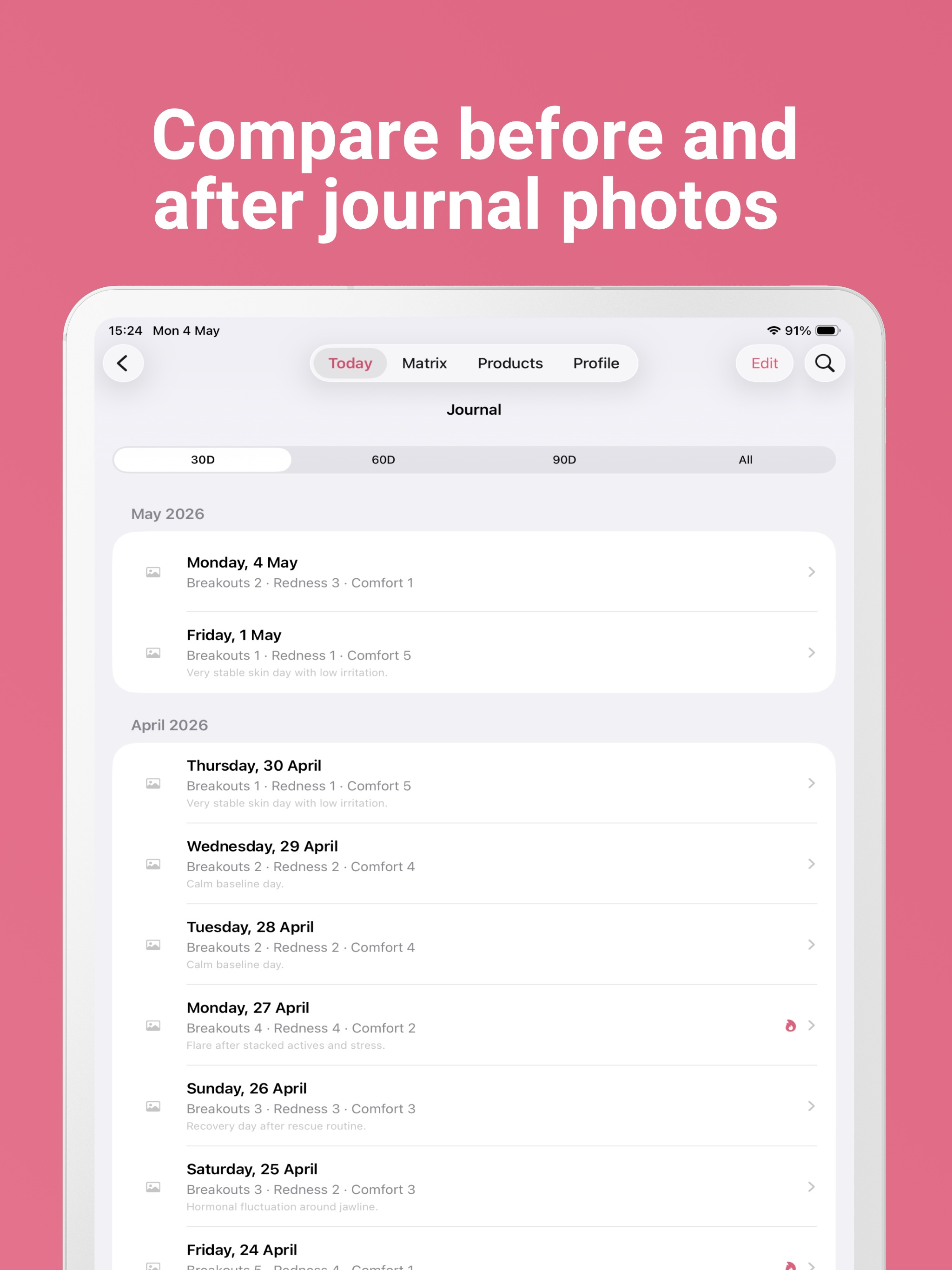 SkinLattice: Skincare Tracker