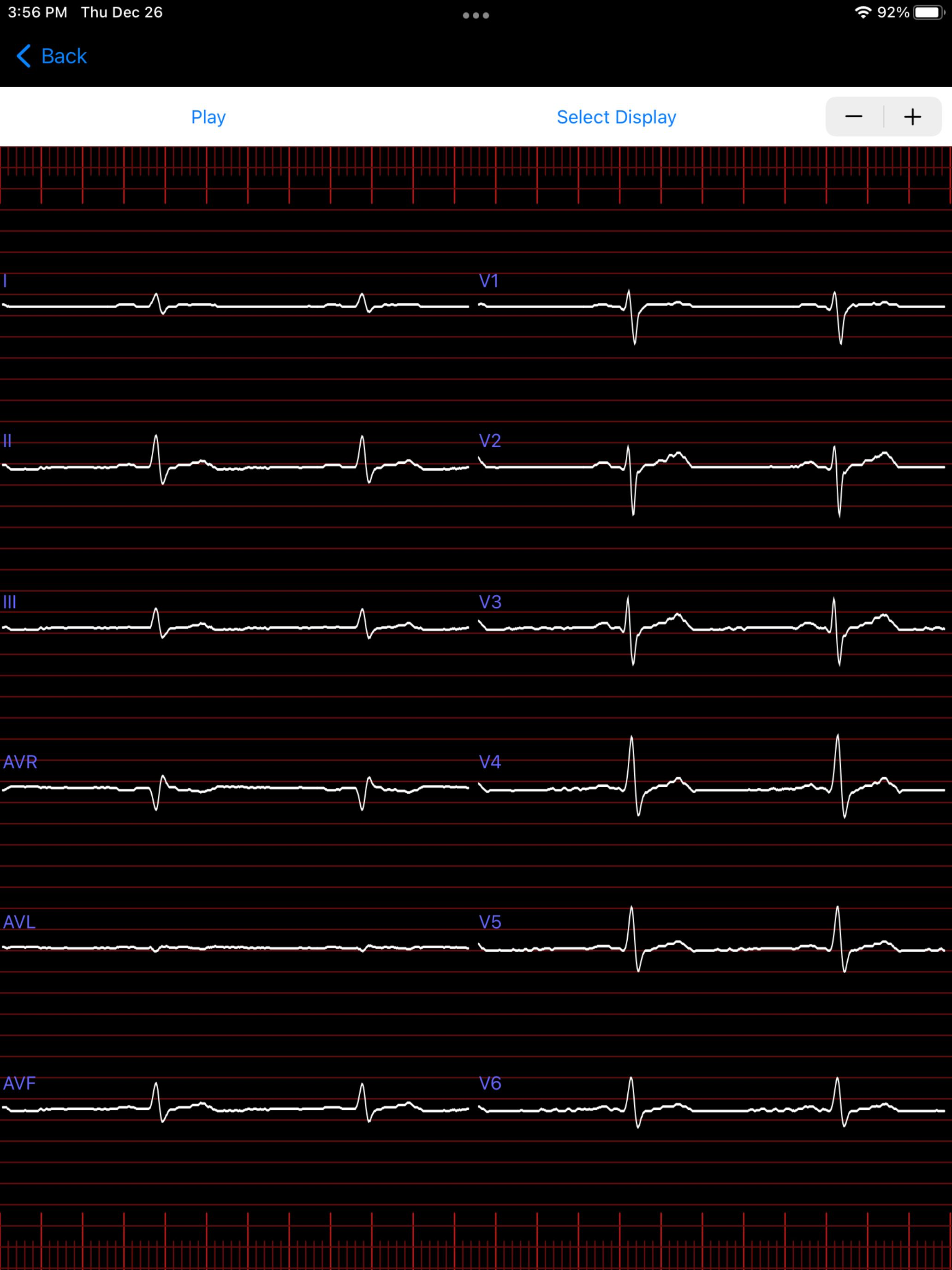 Nasiff CardioCard Mobile