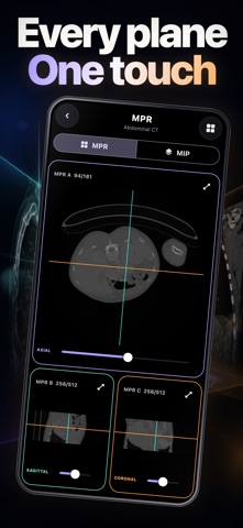 DICOM Viewer: MRI CT Studio 스크린샷 4