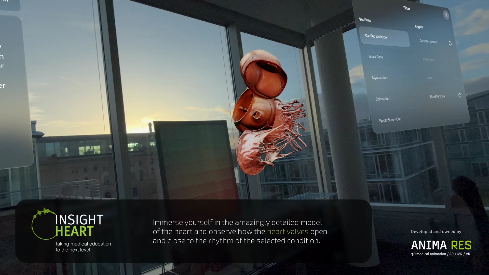 INSIGHT HEART screenshot 6