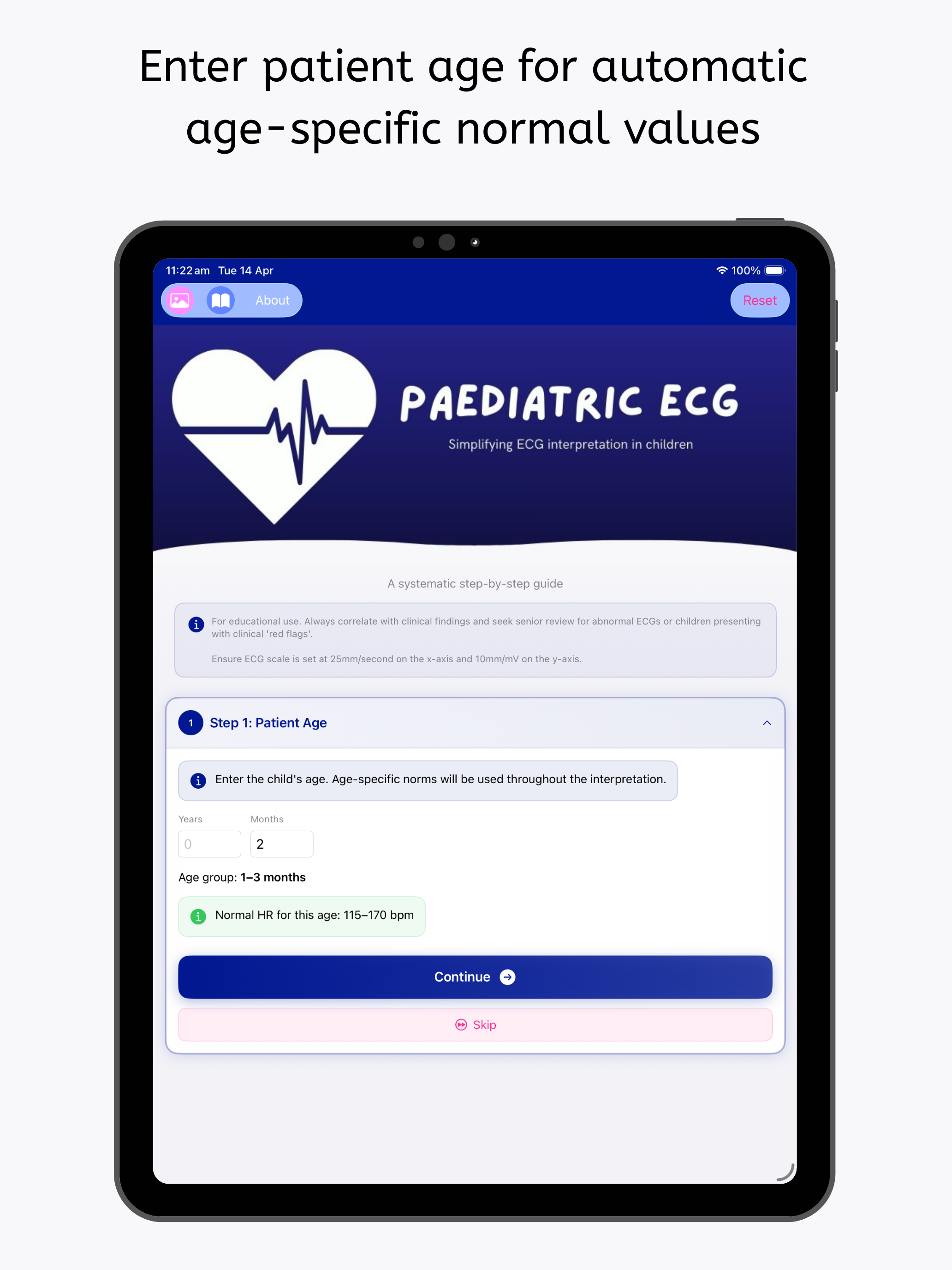 Paediatric ECG screenshot 12