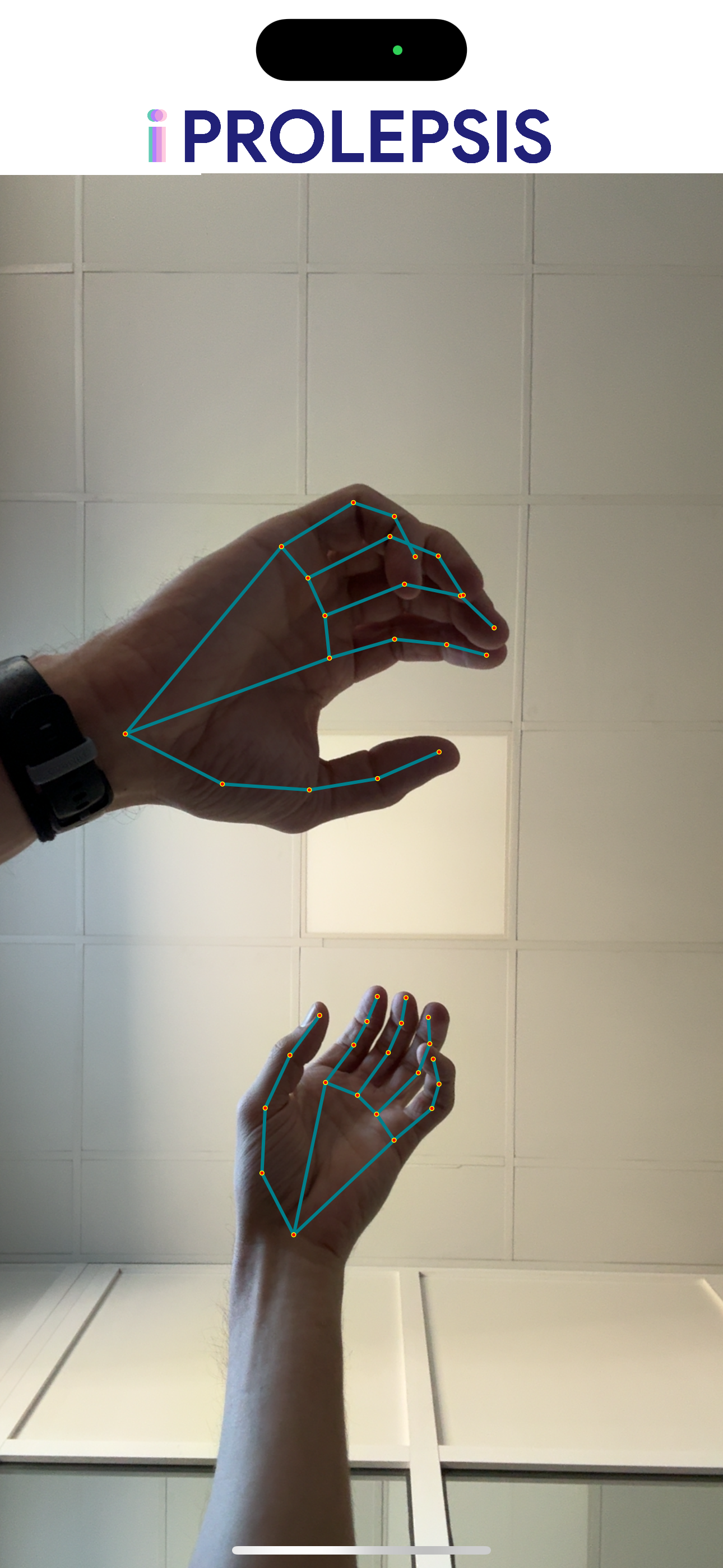 miPROLEPSIS Joint Landmarker screenshot 10