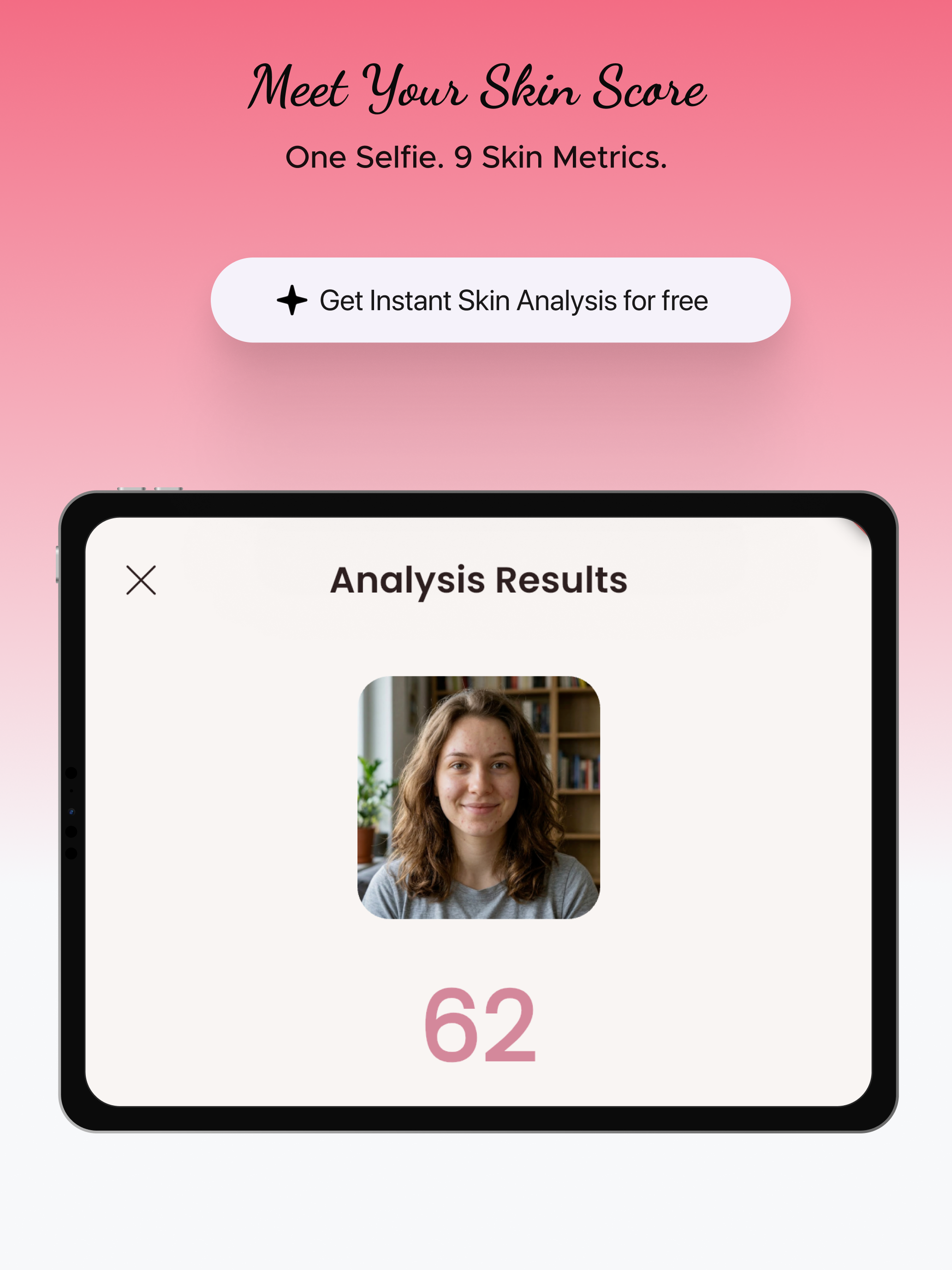 Radiate — AI Skin Scanner