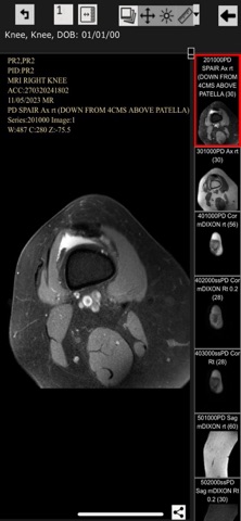 Voyager Radiology Image Viewer screenshot