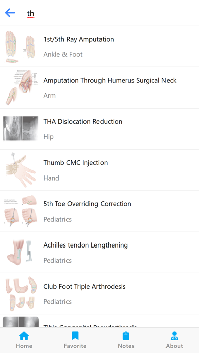 Orthopedic Surgery Techniques Screenshot