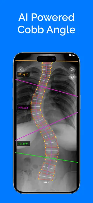 SpineRef screenshot 3