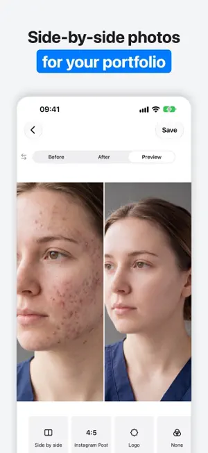 Before/After: Photo Compare screenshot 2