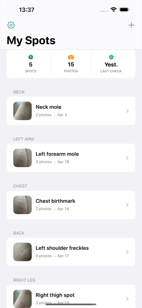 Screenshot #2 pour Mole Tracker: Skin Photo Diary