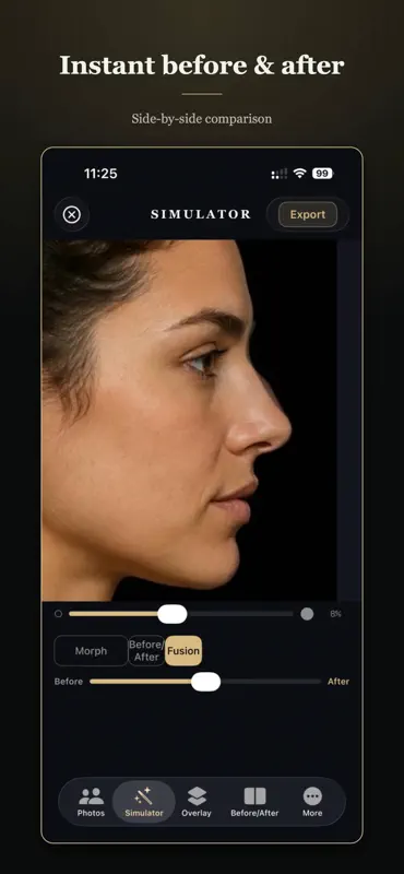 Rhinoplasty Simulator Pro screenshot 2 of 6