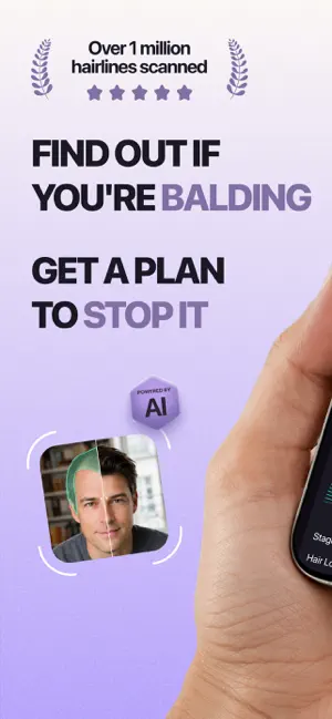 HairLoss AI: Beat Balding screenshot 1