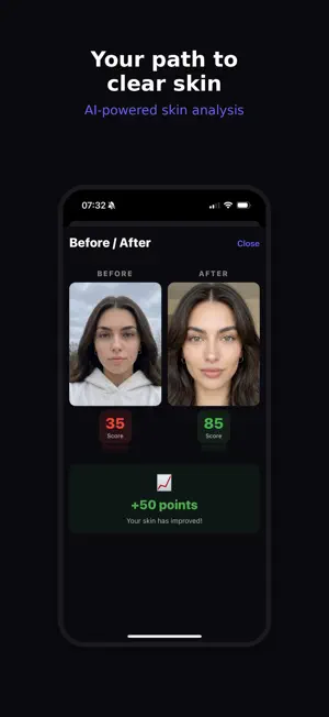 Acnorithm screenshot 2