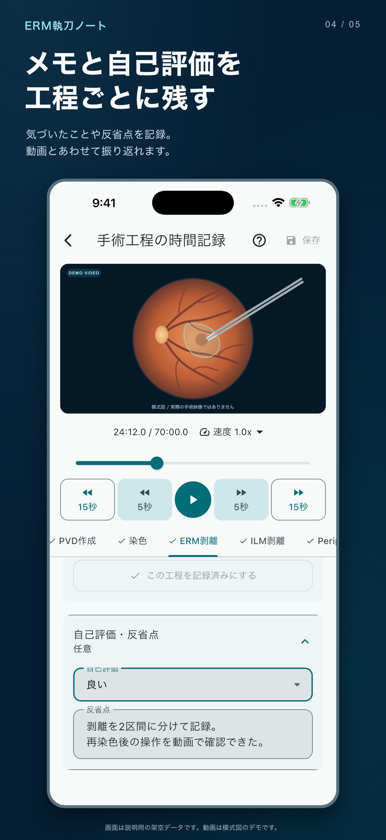 Screenshot 4 of ERM執刀ノート
