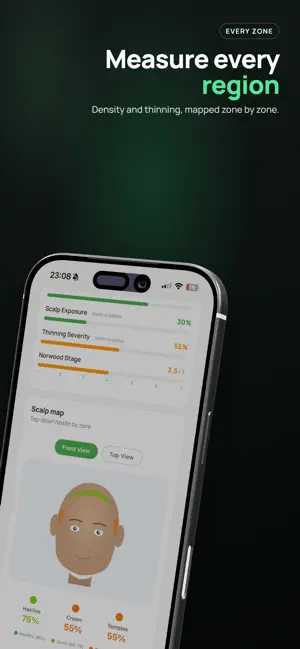 Trichometrics: Hair Loss AI screenshot 4