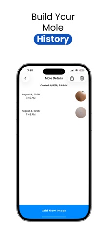 Jeskin Mole Tracker Screenshot 3 of 5