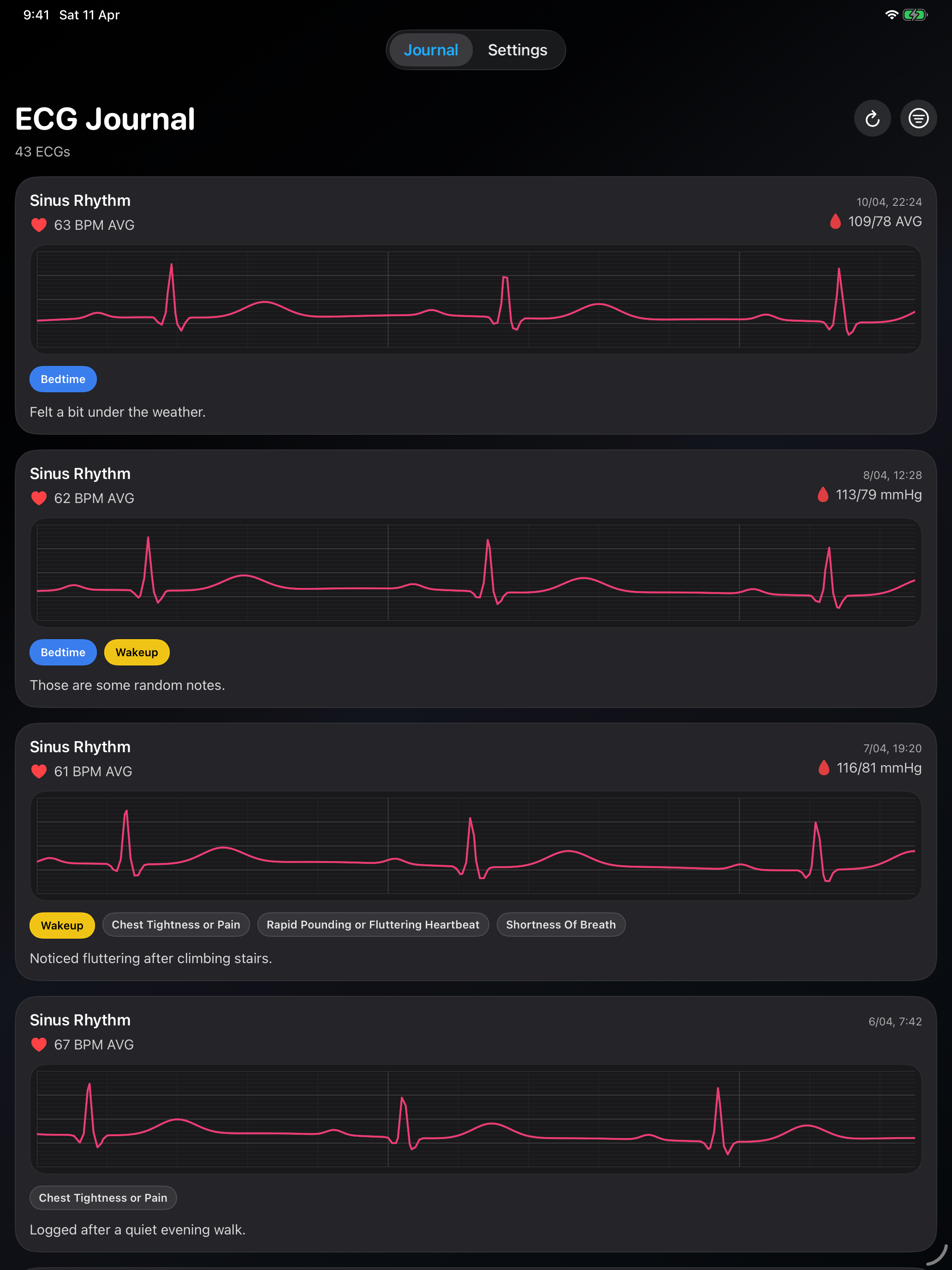 ECG Journal