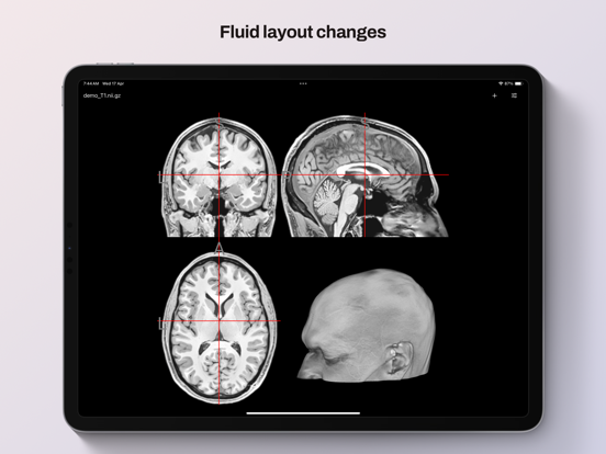 NiiVue iPad screenshot 2 - Medical app