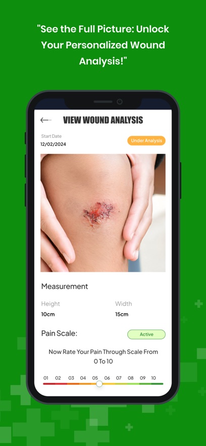WoundWise