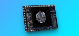 INTERACTIVE MRI ATLAS のスクリーンショット