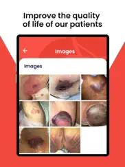 wound care pro ipad images 4
