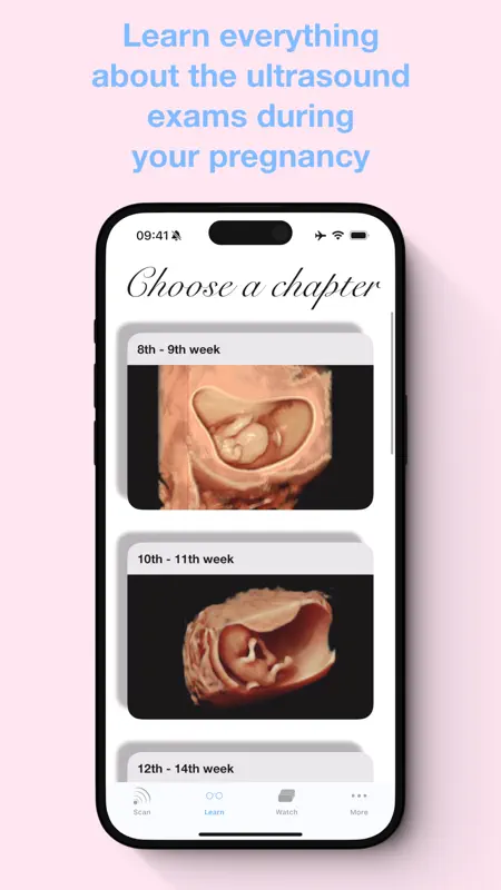 ScanBaby learn baby ultrasound screenshot 7 of 8