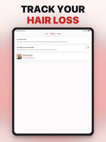 Baldo: AI Balding Analysis iPad screenshot