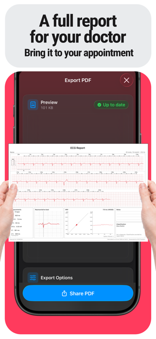 ECG Tracker+ EKG Reader HRV Screenshot 5 of 6