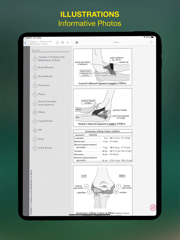 Radiology Review Manual iPad screenshot 4 - Medical app