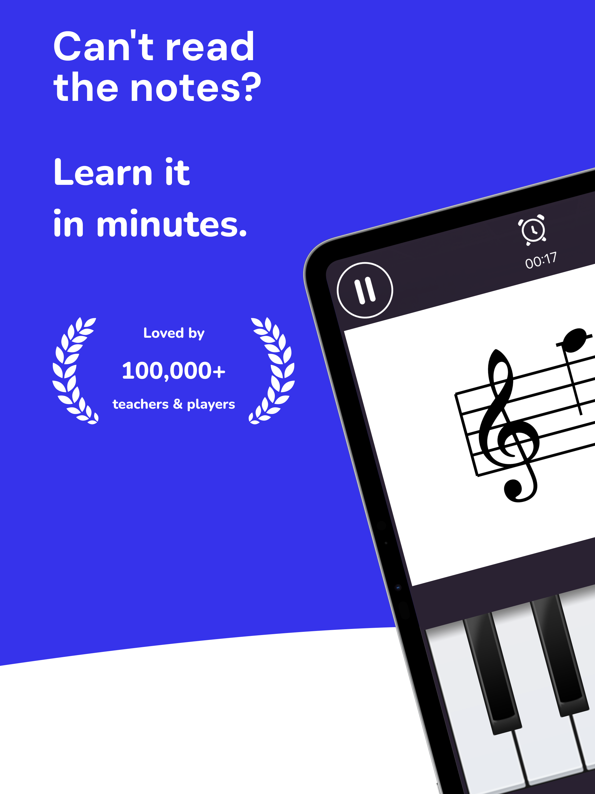 Learn Music Notes - ChordIQ