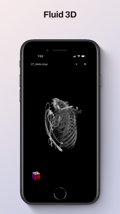 NiiVue iPhone screenshot 2 - Medical app